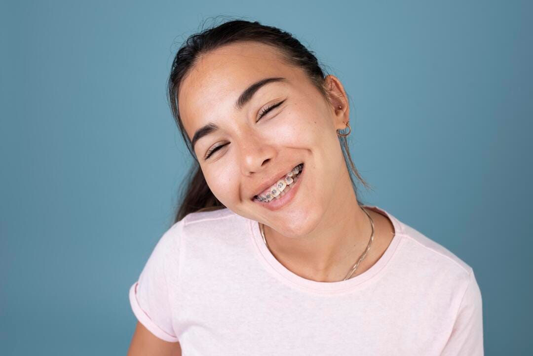 Joven sonriente con brackets metálicos, tratamiento de ortodoncia fija en Fuengirola, en la clínica dental Avilés DDC.