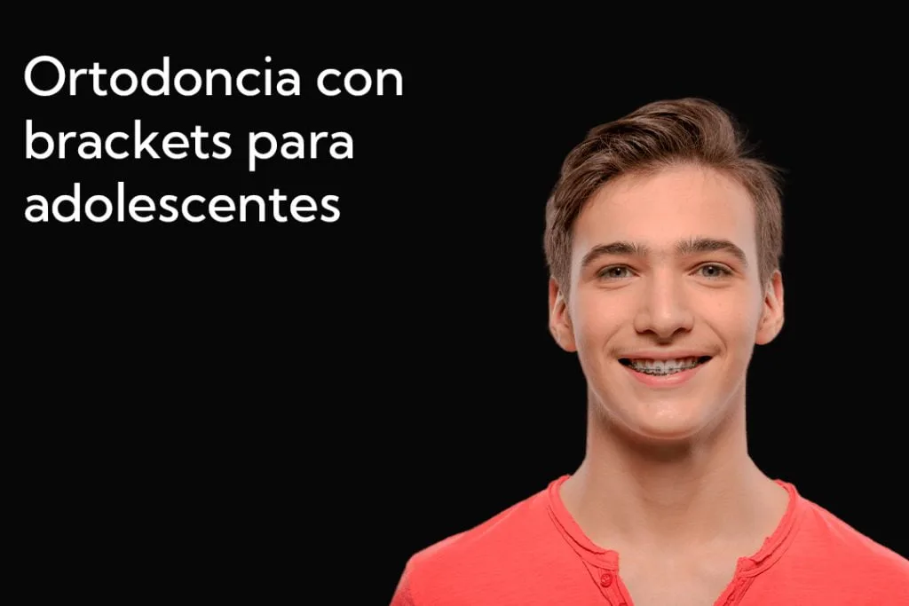 Adolescente sonriendo con brackets, representando tratamientos de ortodoncia fija para adolescentes en la clínica dental Avilés DDC Fuengirola